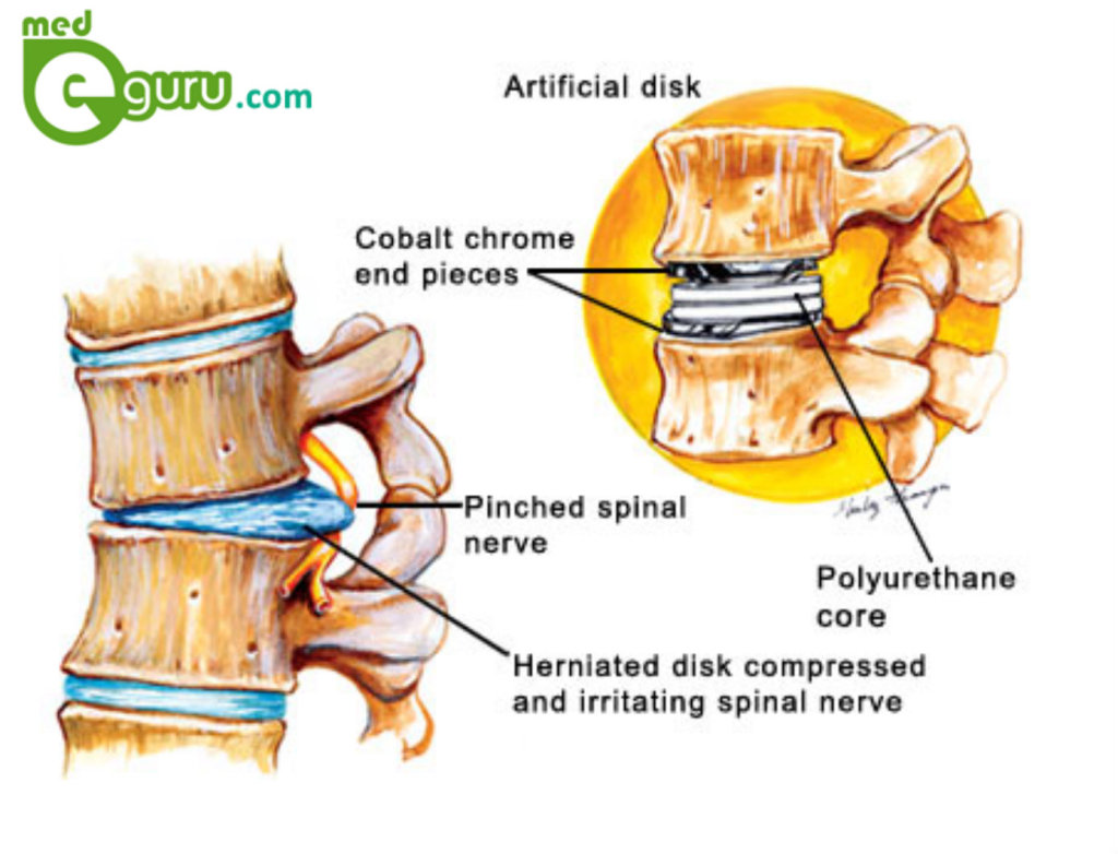 Disk Replacement  Diagram