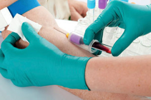 hormonaltesting