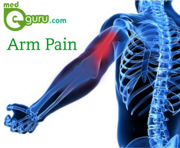 Arm Pain Diagram