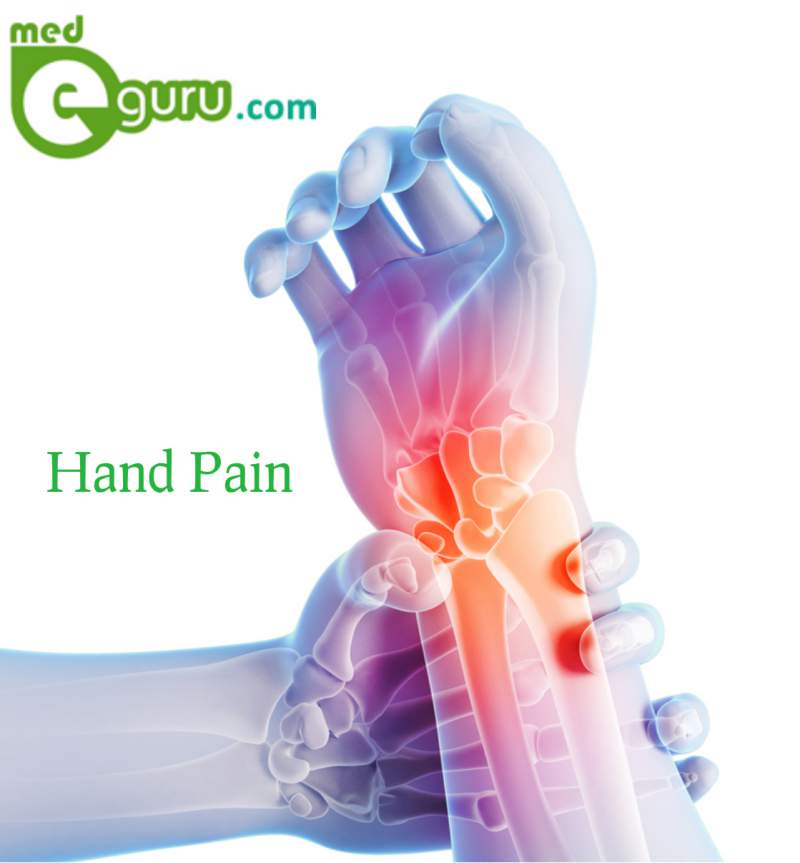 Hand pain diagram