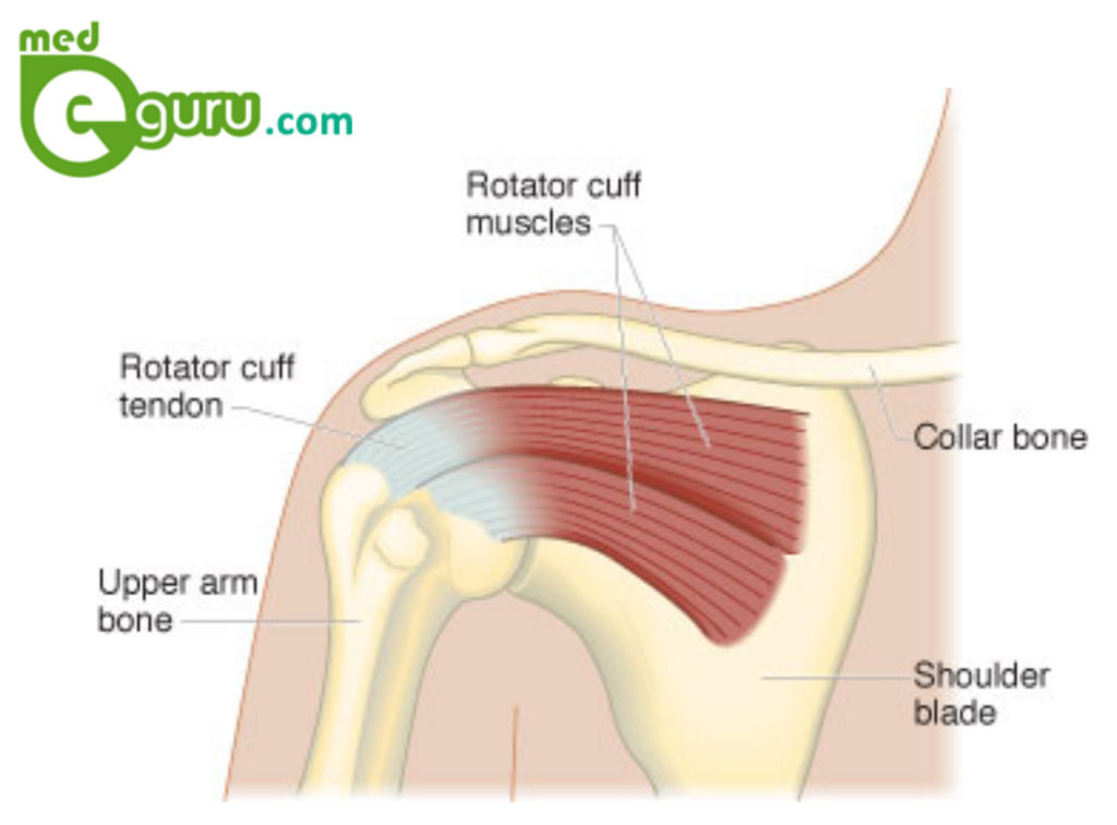 shoulder pain