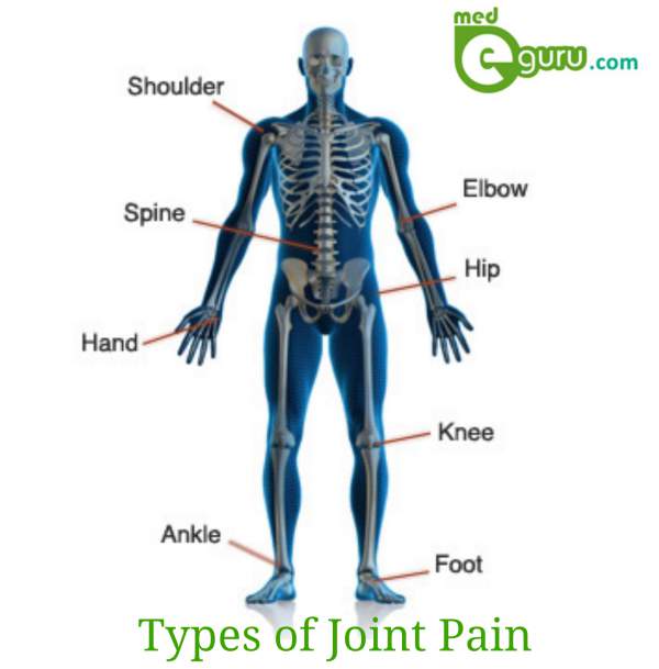 Types of Joint pain diagram